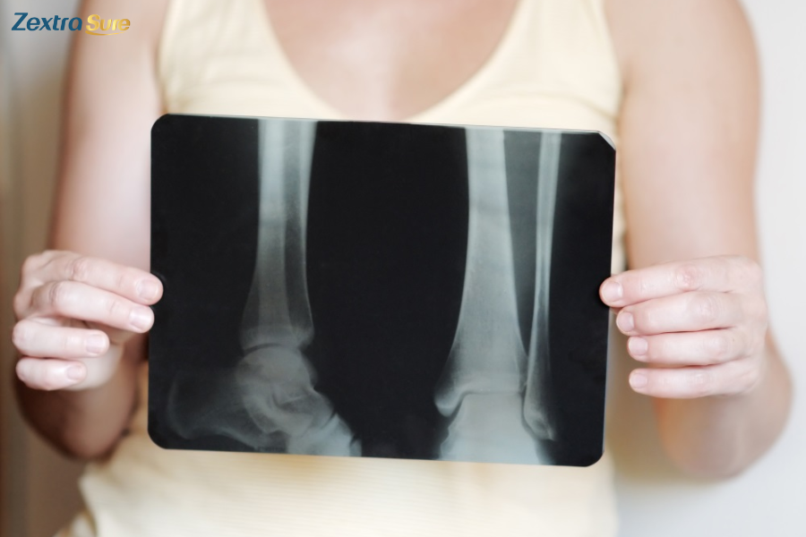 Understanding the causes of bone marrow edema can answer the question: Can bone marrow edema be cancer?